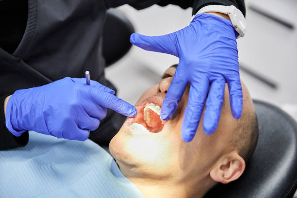 Best Emergency Dentist for Lost Fillings or Crowns in Lyons, OR