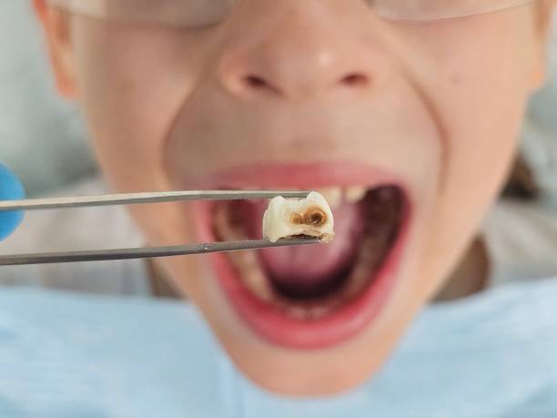 Best Pediatric Emergency Dentist in Lyons, OR